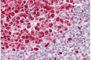 Anti-PCNA / Cyclin antibody IHC staining of human tonsil.