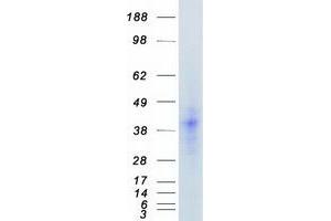 Western Blotting (WB) image for Fibroblast Growth Factor 2 (Basic) (FGF2) protein (Myc-DYKDDDDK Tag) (ABIN2721045)