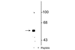 Western blot of rat hippocampal lysate showing specific immunolabeling of the ~58 kDa GABAA β3 protein phosphorylated at Ser408/409 in the first lane (-). (GABRB3 Antikörper  (pSer408, pSer409))