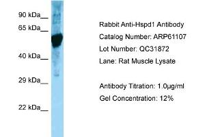 Western Blotting (WB) image for anti-Heat Shock 60kDa Protein 1 (Chaperonin) (HSPD1) (C-Term) antibody (ABIN2788677)