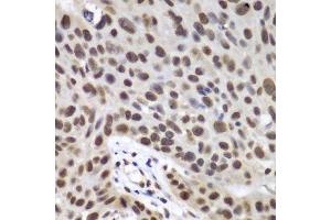 Immunohistochemistry (Paraffin-embedded Sections) (IHC (p)) image for anti-DEAD (Asp-Glu-Ala-Asp) Box Polypeptide 5 (DDX5) (AA 1-614) antibody (ABIN6139505)