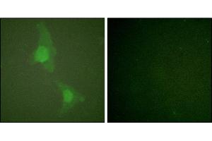 Immunofluorescence analysis of HeLa cells, using ADD1 (Ab-726) antibody. (alpha Adducin Antikörper)