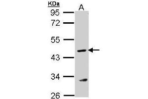 WB Image Sample (30 ug of whole cell lysate) A: MOLT4 , 10% SDS PAGE antibody diluted at 1:1000 (ASL Antikörper)