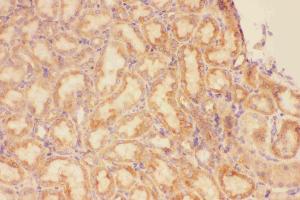 Anti-CXCR3 Picoband antibody, IHC(P): Rat Kidney Tissue (CXCR3 Antikörper  (AA 1-368))