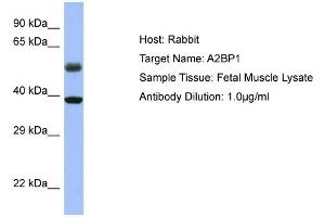WB Suggested Anti-A2BP1 Antibody Titration: 0. (A2BP1 Antikörper  (N-Term))