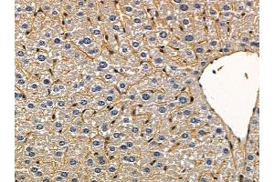 ABIN6258935 and ABIN6275451 at 1/100 staining mouse liver tissue by IHC-P. (G3BP2 Antikörper  (C-Term))