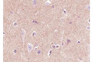 ABIN6268720 at 1/100 staining human brain tissue sections by IHC-P. (Nerve Growth Factor Antikörper  (Internal Region))