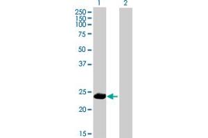 Western Blot analysis of PPP1R2P9 expression in transfected 293T cell line by PPP1R2P9 MaxPab polyclonal antibody. (PPP1R2P9 Antikörper  (AA 1-202))