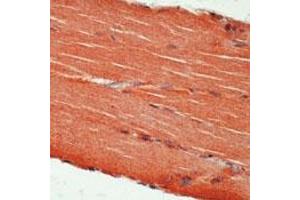 Formalin-fixed, paraffin-embedded human skeletal muscle stained with c-erbB3 Ab using peroxidase-conjugate and AEC chromogen. (ERBB3 Antikörper)