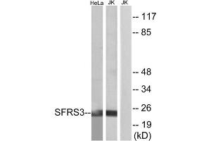 Western blot analysis of extracts from HeLa cells and Jurkat cells, using SFRS3 antibody. (SRSF3 Antikörper  (C-Term))