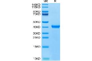 Canine S100B on Tris-Bis PAGE under reduced condition. (S100B Protein (AA 2-92) (Fc Tag))