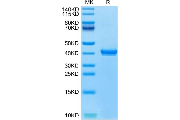 S100B Protein (AA 2-92) (Fc Tag)