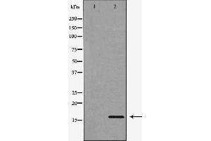 Western blot analysis of extracts of NCI-H460, using CST3 antibody. (CST3 Antikörper)