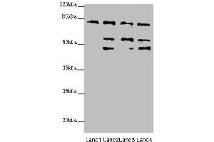 Western blot analysis of (1) HeLa whole cell lysates, (2) 293T whole cell lysates, (3) Mouse liver tissue, and (4) Mouse kidney tissue, using ZFYVE1 antibody (6. (ZFYVE1 Antikörper  (AA 1-280))