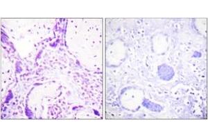 Immunohistochemistry analysis of paraffin-embedded human placenta tissue, using PPAR-gamma (Ab-112) Antibody. (PPARG Antikörper  (AA 78-127))