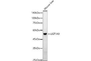 Western blot analysis of extracts of Mouse liver, using UGT1 antibody (ABIN3022342, ABIN3022343, ABIN3022344 and ABIN6218752) at 1:1000 dilution. (UGT1A9 Antikörper  (AA 26-250))