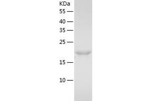 Western Blotting (WB) image for B-Cell CLL/lymphoma 2 (BCL2) (AA 5-205) protein (His tag) (ABIN7285261) (Bcl-2 Protein (AA 5-205) (His tag))