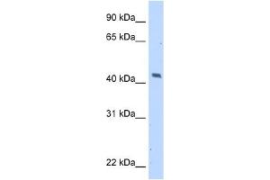 MAGEA1 antibody used at 5 ug/ml to detect target protein. (MAGEA1 Antikörper)