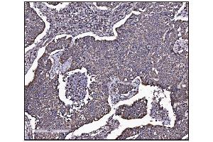 IHC analysis of FABP-1/GOT2 using anti-FABP-1/GOT2 antibody (ABIN7601426). (GOT2 Antikörper  (AA 35-430))