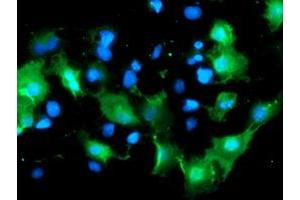 Anti-DOK7 mouse monoclonal antibody (ABIN2455827) immunofluorescent staining of COS7 cells transiently transfected by pCMV6-ENTRY DOK7 (RC219267). (DOK7 Antikörper)