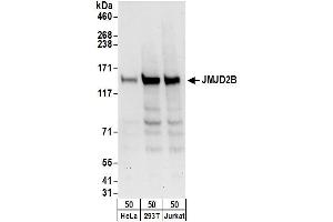 Western Blotting (WB) image for anti-Lysine (K)-Specific Demethylase 4B (KDM4B) (AA 1056-1096) antibody (ABIN7451825) (KDM4B Antikörper  (AA 1056-1096))