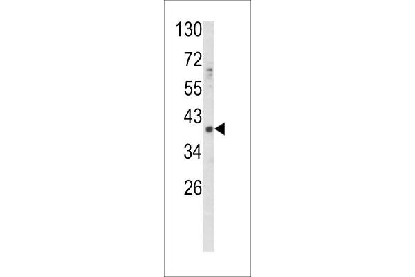 GDF1 Antikörper  (N-Term)