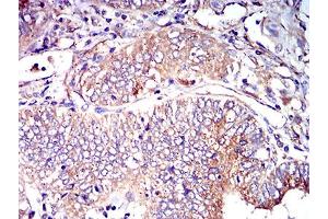 Immunohistochemistry (IHC) image for anti-Intercellular Adhesion Molecule 2 (ICAM2) (AA 25-223) antibody (ABIN5611204)