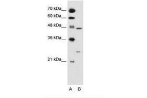 Image no. 1 for anti-Retinoid X Receptor, gamma (RXRG) (AA 101-150) antibody (ABIN6736682) (Retinoid X Receptor gamma Antikörper  (AA 101-150))
