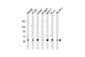 All lanes : Anti-DCLRE1C Antibody (N-term) at 1:2000 dilution Lane 1: HepG2 whole cell lysate Lane 2: HT-29 whole cell lysate Lane 3: Jurkat whole cell lysate Lane 4: mouse heart lysate Lane 5: MCF-7 whole cell lysate Lane 5: PC-3 whole cell lysate Lane 5: ZR-75-1 whole cell lysate Lysates/proteins at 20 μg per lane. (DCLRE1C Antikörper  (N-Term))
