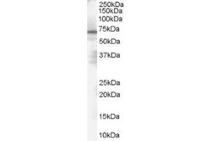 Image no. 1 for anti-Poly (ADP-Ribose) Polymerase 2 (PARP2) (Internal Region) antibody (ABIN374644) (PARP2 Antikörper  (Internal Region))