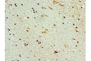 Immunohistochemistry of paraffin-embedded human brain tissue using ABIN7168991 at dilution of 1:100 (STK32A Antikörper  (AA 1-166))