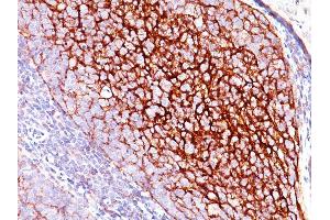 Formalin-fixed, paraffin-embedded human Tonsil stained with CD35 Mouse Monoclonal Antibody (E11). (CD35 Antikörper)