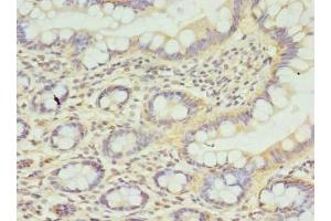 Immunohistochemistry of paraffin-embedded human small intestine tissue using ABIN7146249 at dilution of 1:100 (CPED1 Antikörper  (AA 221-472))