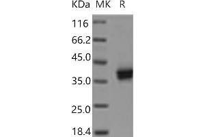 Western Blotting (WB) image for Cell Adhesion Molecule 3 (CADM3) protein (His tag) (ABIN7321187) (CADM3 Protein (His tag))