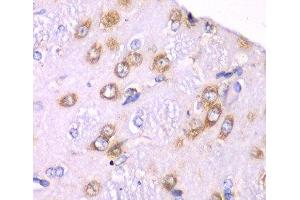 Immunohistochemistry of paraffin-embedded Rat brain using RPS3A Polyclonal Antibody at dilution of 1:100 (40x lens). (RPS3A Antikörper)