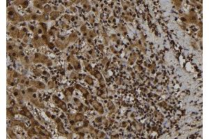 ABIN6277753 at 1/100 staining Human liver tissue by IHC-P. (PYDC1 Antikörper)