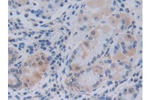 Immunohistochemistry (IHC) image for anti-Tumor Necrosis Factor (Ligand) Superfamily, Member 9 (TNFSF9) (AA 42-253) antibody (ABIN7441109)