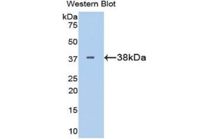 Detection of Recombinant LDHB, Mouse using Polyclonal Antibody to Lactate Dehydrogenase B (LDHB) (LDHB Antikörper  (AA 1-334))
