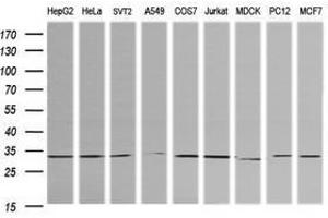 Image no. 2 for anti-Retinoic Acid Receptor Responder (Tazarotene Induced) 1 (RARRES1) antibody (ABIN1500602)