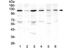 Western blot testing of human 1) HeLa, 2) HepG2, 3) SGC-7901, 4) K562, 5) rat testis and 6) mouse testis lysate with PDGFRB antibody at 0. (PDGFRB Antikörper  (AA 911-992))