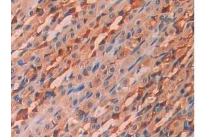 Immunohistochemistry (IHC) image for anti-Carbonic Anhydrase 12 (CA12) (AA 154-307) antibody (ABIN7437902)