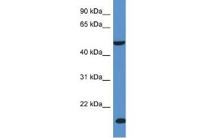 WB Suggested Anti-INPP5K Antibody Titration: 1. (INPP5K Antikörper  (C-Term))