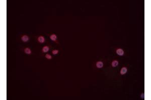 ABIN6277494 staining Hela cells by IF/ICC. (FOXP1 Antikörper  (C-Term))