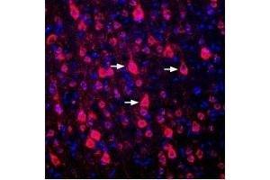 Expression of DRD1 in rat cortexImmunohistochemical staining of perfusion-fixed frozen rat brain sections using Guinea pig Anti-D1 Dopamine Receptor Antibody (ABIN7043106, ABIN7045428 and ABIN7045429), (1:300), followed by goat-anti-guinea pig-Cy3 antibody. (Dopamine Receptor D1 (DRD1) Peptid)