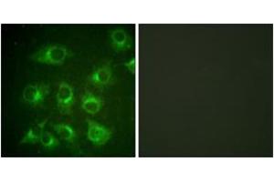 Immunofluorescence (IF) image for anti-V-Crk Sarcoma Virus CT10 Oncogene Homolog (Avian) (CRK) (AA 187-236) antibody (ABIN2888595) (Crk Antikörper  (AA 187-236))