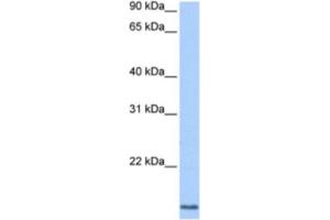 Western Blotting (WB) image for anti-Cyclin L2 (CCNL2) antibody (ABIN2463361)