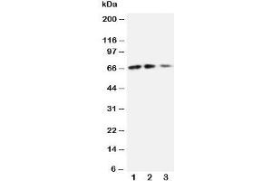 Western blot testing of CX3CL1 antibody and Lane 1:  recombinant mouse protein 10ng;  2: 5ng;  3: 2. (CX3CL1 Antikörper  (N-Term))
