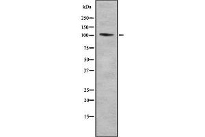 Western blot analysis of TTF1 using HepG2 whole cell lysates (TTF1 Antikörper  (Internal Region))