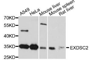 Western blot analysis of extracts of various cell lines, using EXOSC2 antibody. (EXOSC2 Antikörper  (AA 1-293))