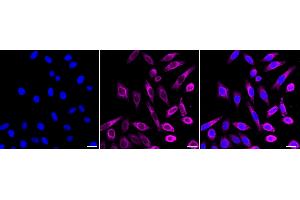 Immunocytochemical staining of HepG2 cells with NCK2 antibody (ABIN7799563), 1:1,000).